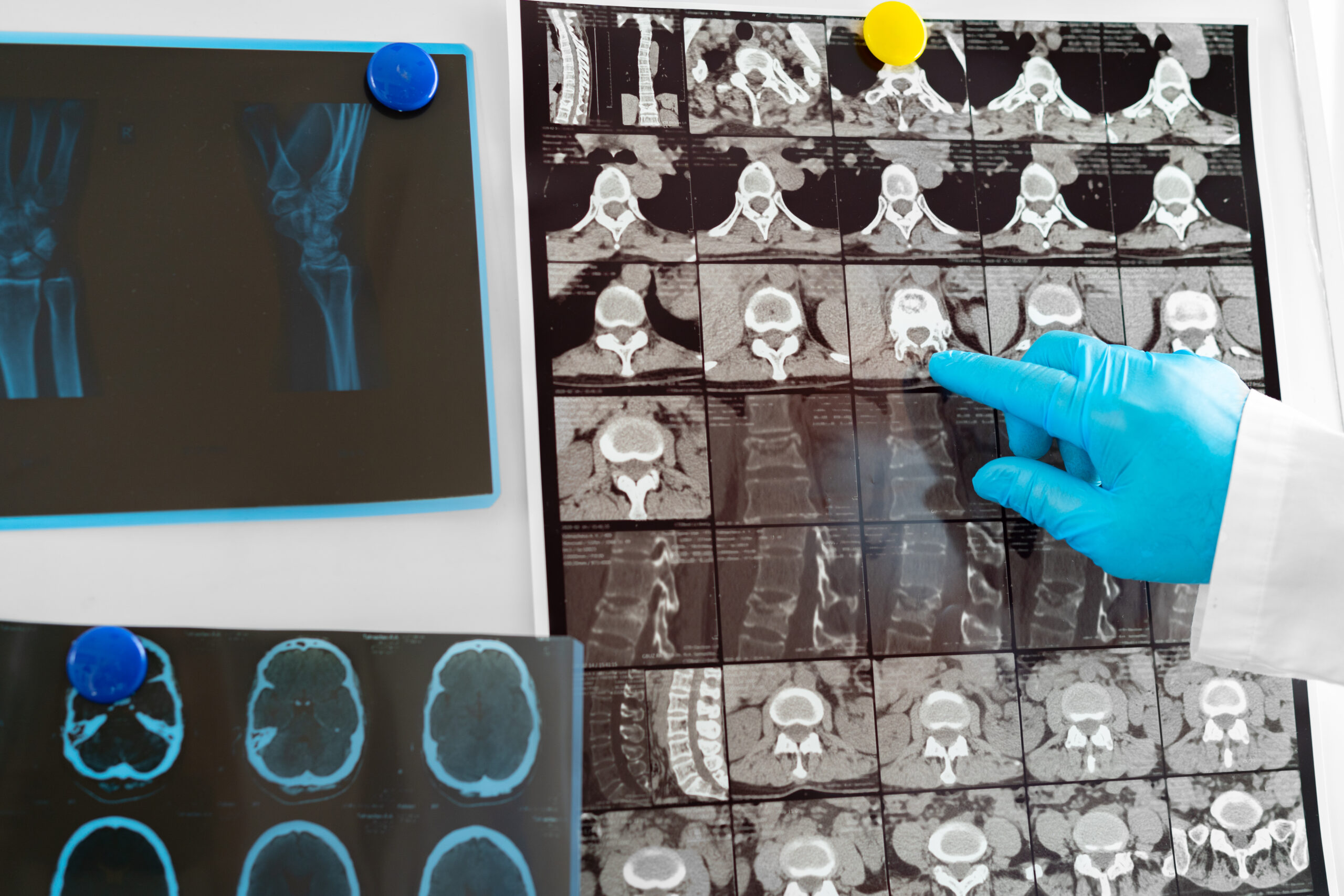 Hands of a doctor holding head mri scan