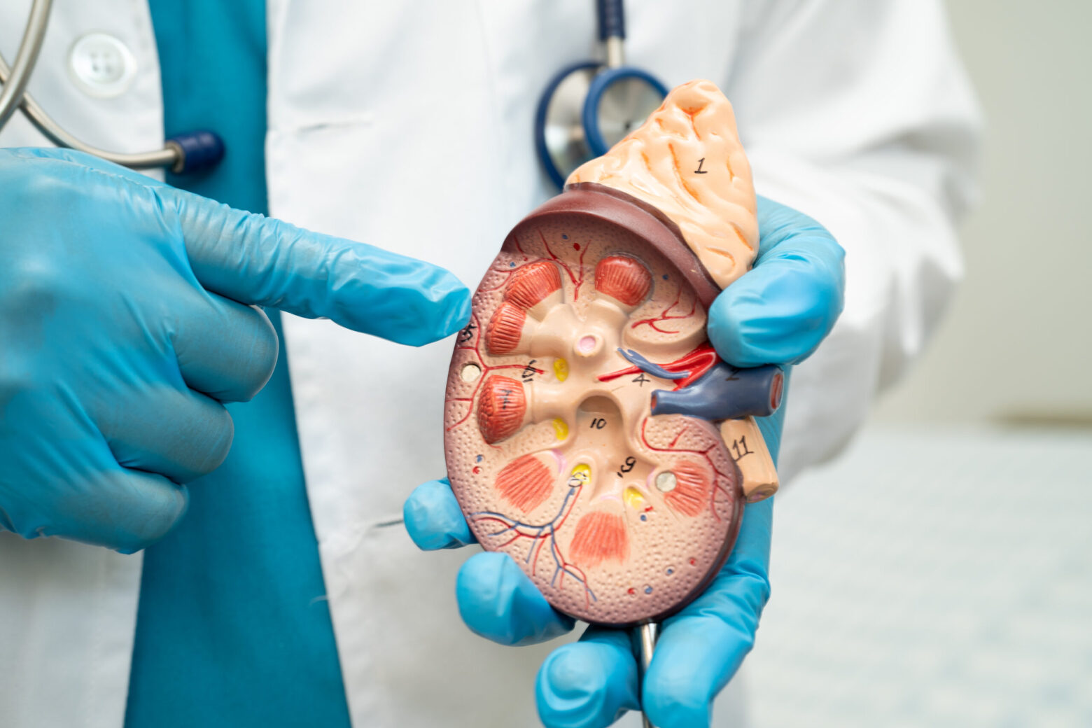 Kidney disease, Chronic kidney disease ckd, Doctor hold human mo