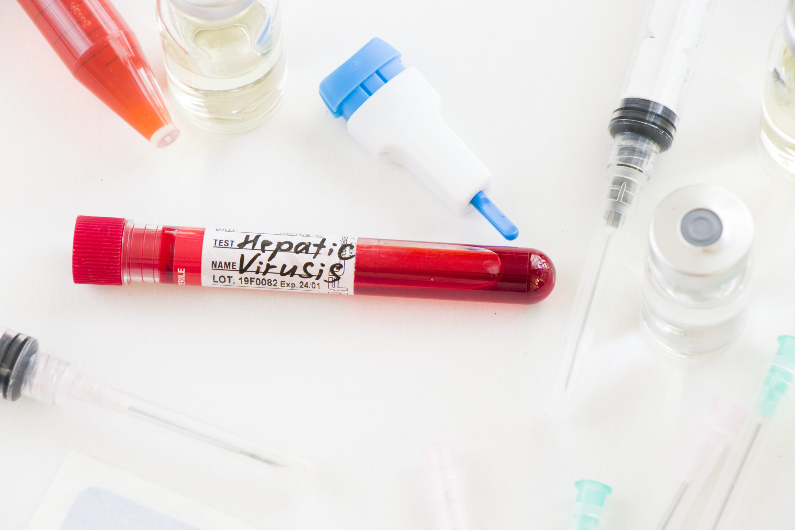 Closeup shot of a Hepatitis C blood test sample on a diagnostic lab table