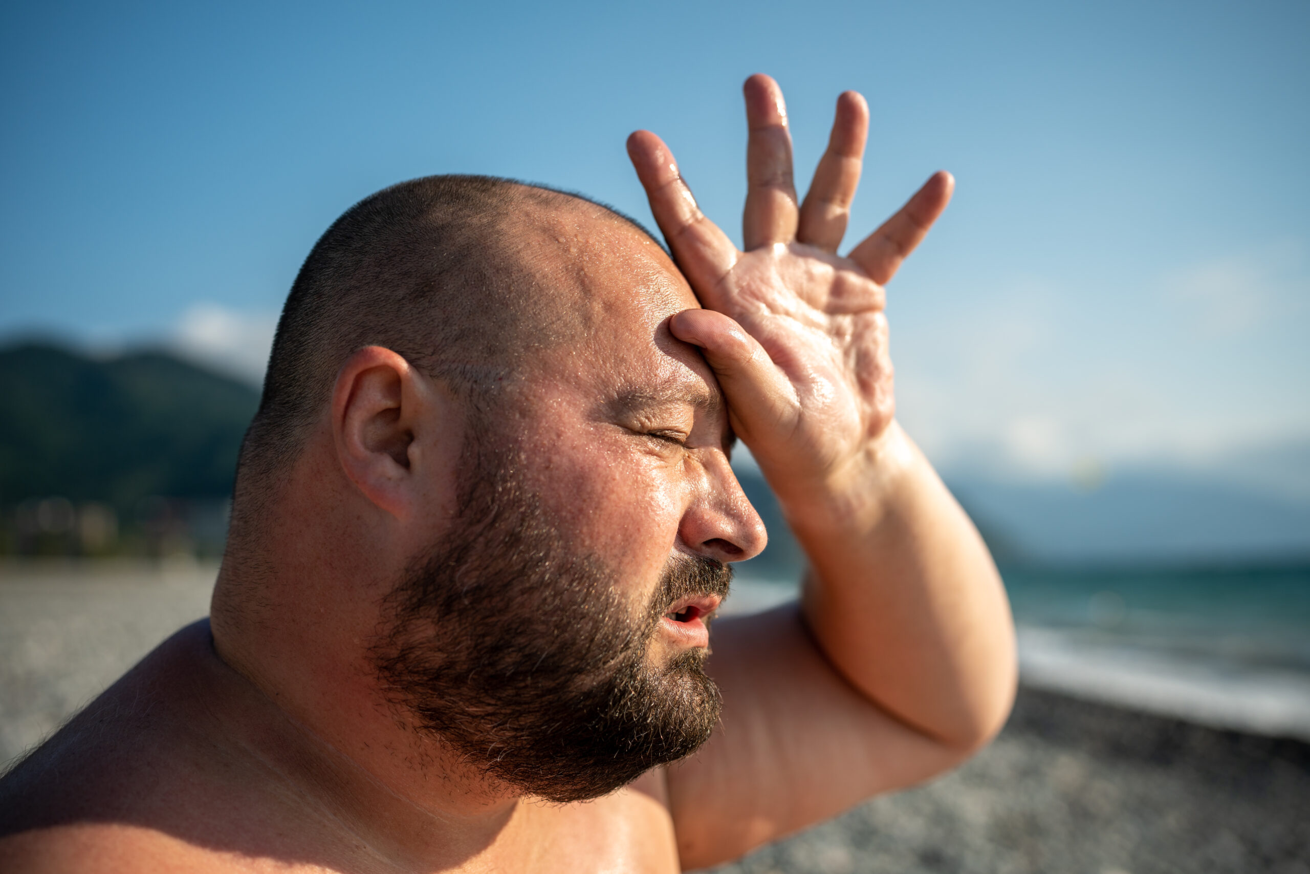 Heavyset man wipes sweat, shields head from sun after heatstroke on beach. Extreme heat under sun