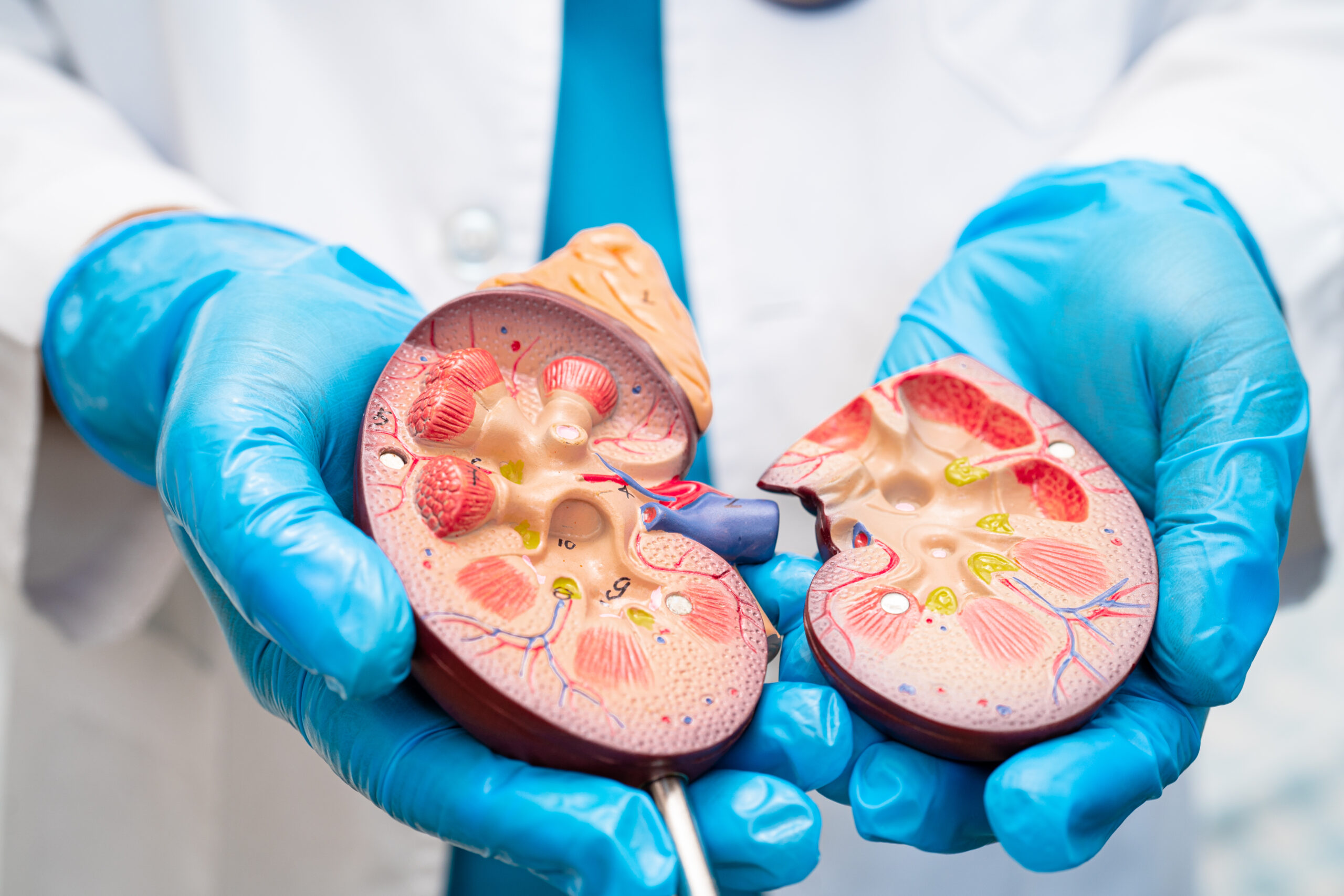 Kidney disease, Chronic kidney disease ckd, Doctor hold human mo
