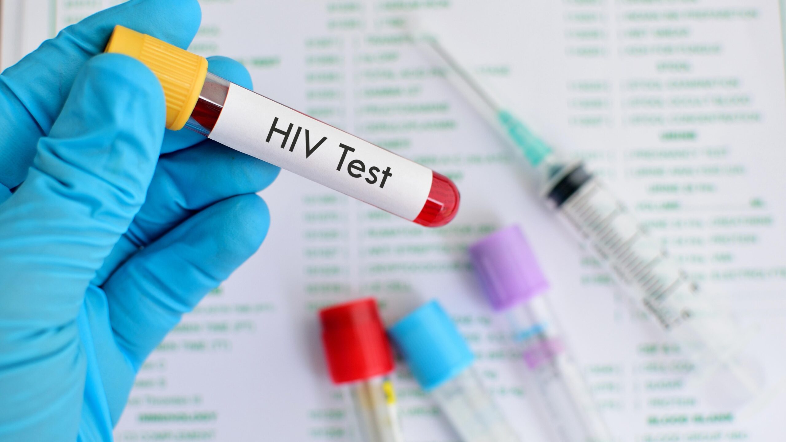 HIV virus, medical concept, Human Immunodeficiency Virus Positive test