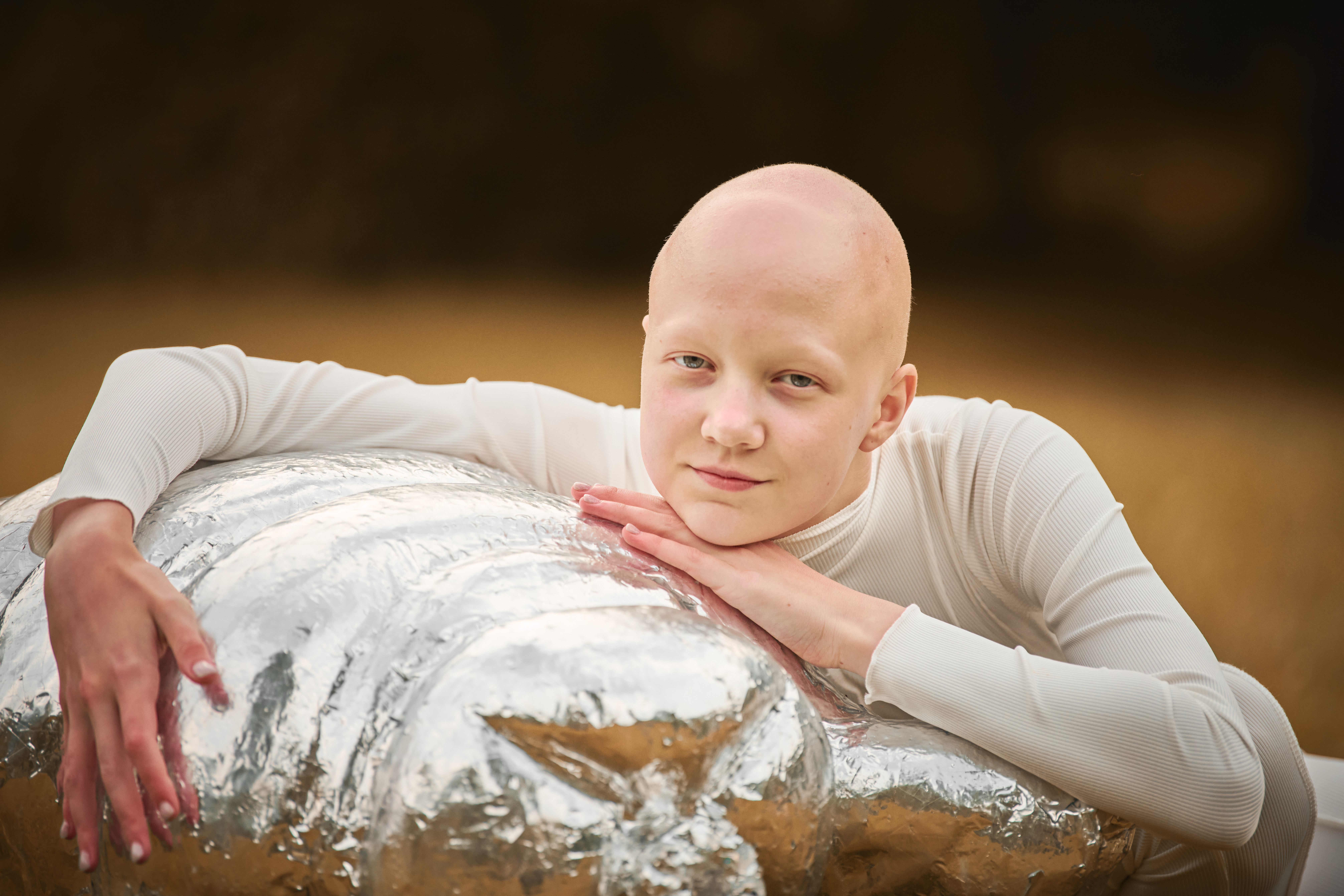 Portrait of young hairless girl with alopecia in white cloth hugging figure of tardigrade