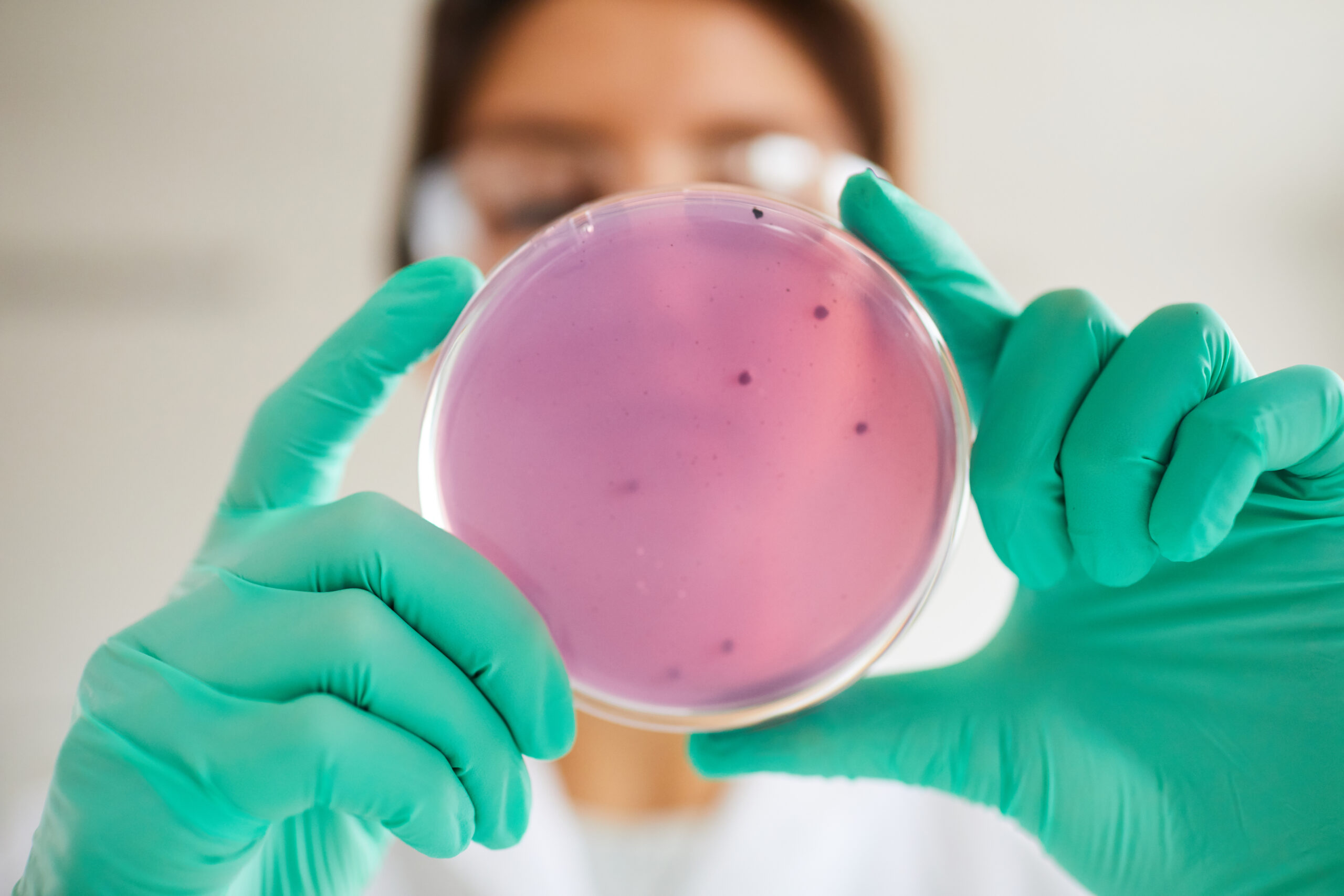 Petri Dish Sample Low Angle