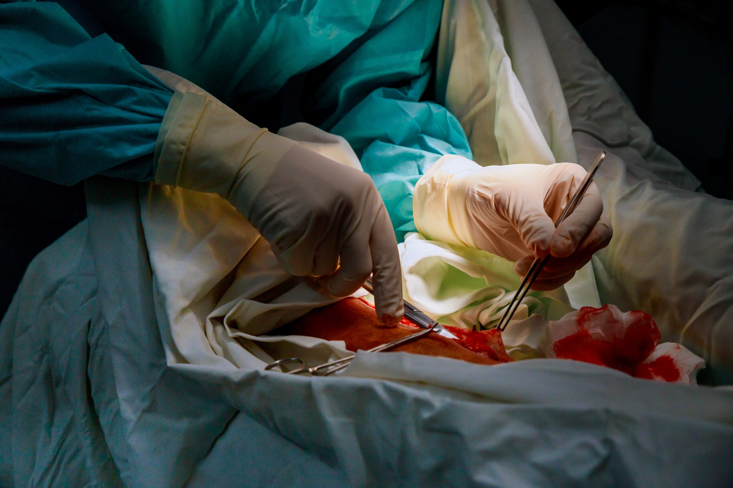 Surgeons team working with leg of patient in operating room.