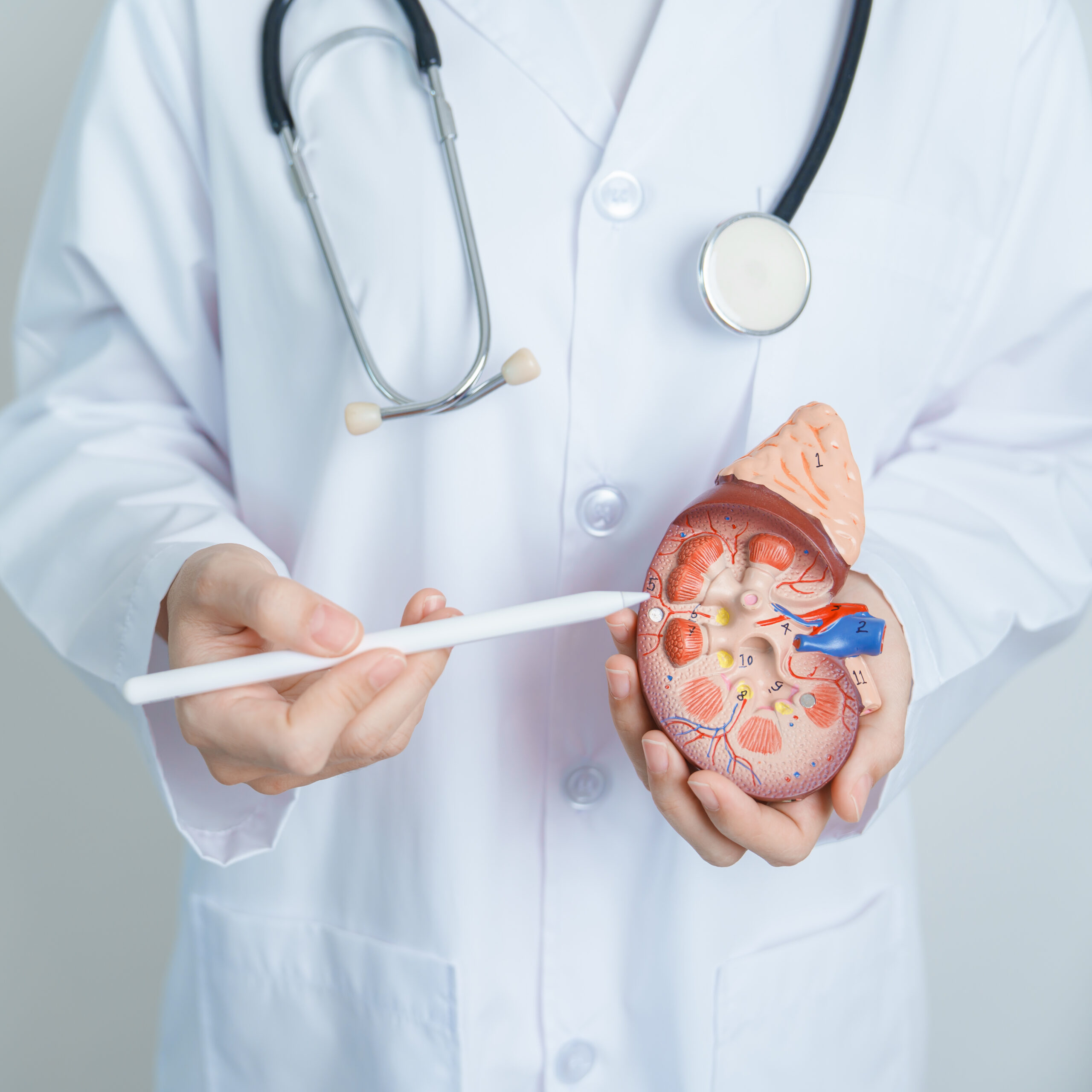 Doctor holding Anatomical kidney Adrenal gland model. disease of