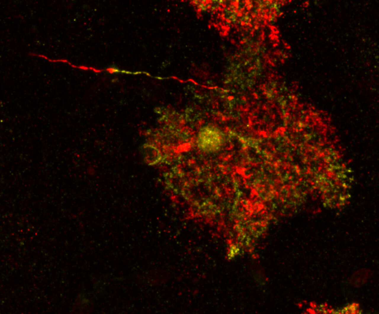 Astrocitos patológicos en el cerebro Imágenes de astrocitos con proyecciones varicosas en un estudio del CSIC.