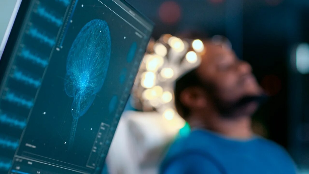 Escáner cerebral mostrando actividad eléctrica durante el sueño de un paciente