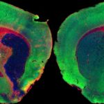 Una molécula del organismo reduce la inflamación y el daño cerebral tras un ictus, según un estudio preclínico del CSIC