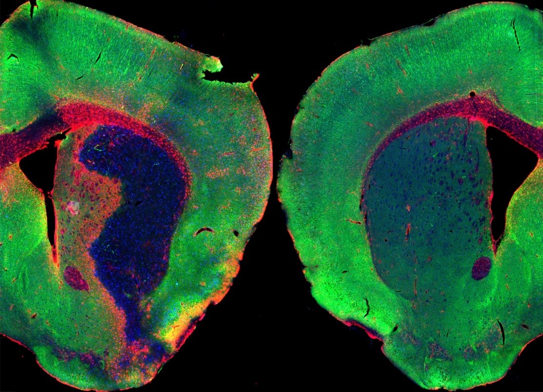 Imagen de fluorescencia del cerebro de ratón sano y tras un ictus
