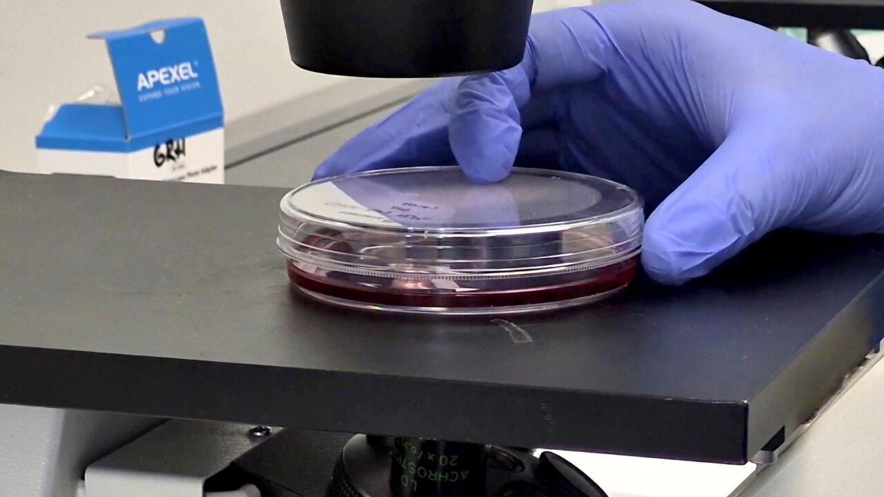 Vacuna oral contra el Ébola en investigación Investigador manipulando una placa de Petri en un laboratorio sobre el Ébola